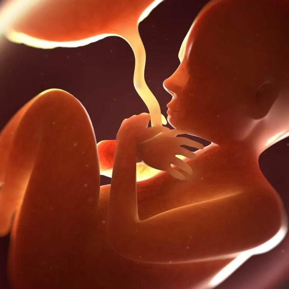 تكلس المشيمة