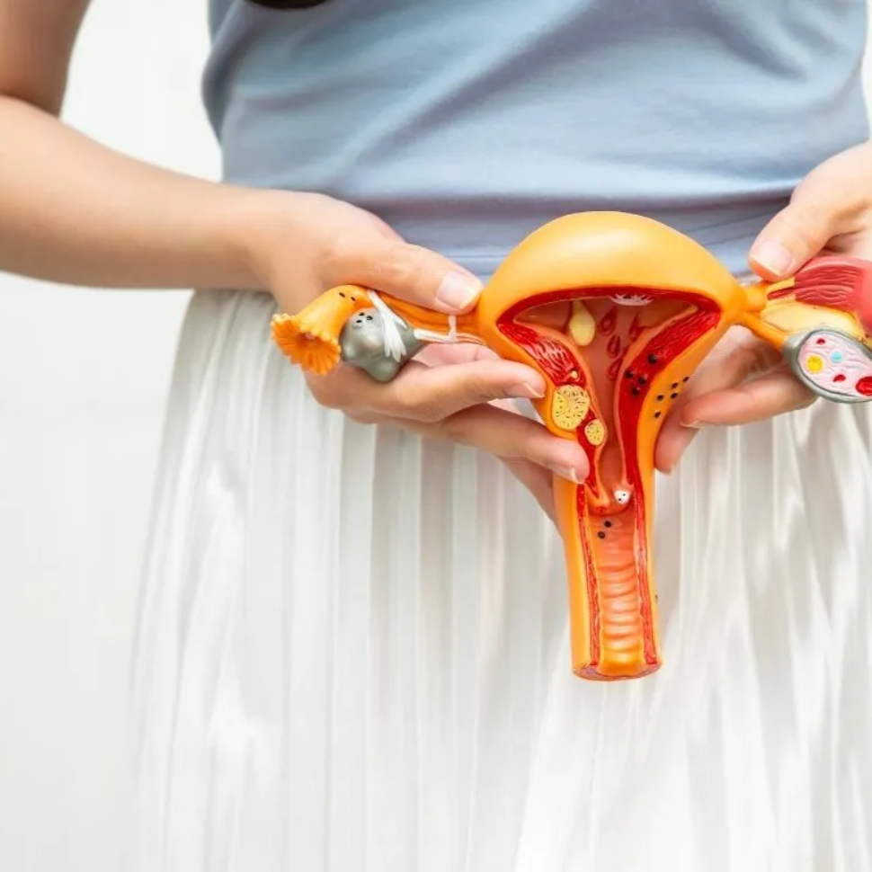 الأورام الليفية